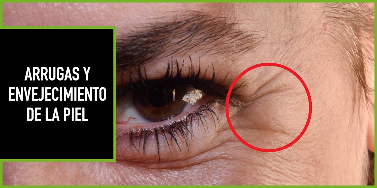 arrugas-y-envejecimiento-piel-cbd Arrugas y envejecimiento de la piel con CBD