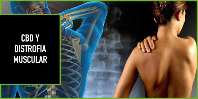 cbd-distrofia-muscular cbd distrofia muscular