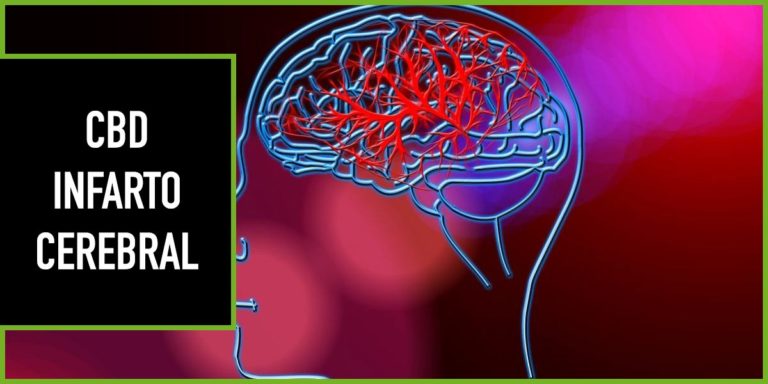 cbd-infarto-cerebral cbd ictus