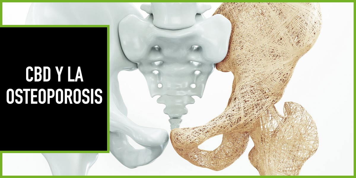 CBD y osteoporosis