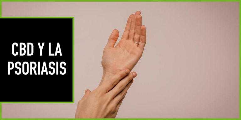 cbd-psoriasis cbd psoriasis